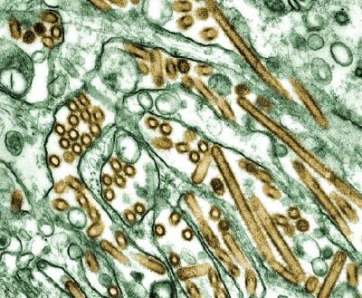 Freedom Scope - Avian Flu Cells